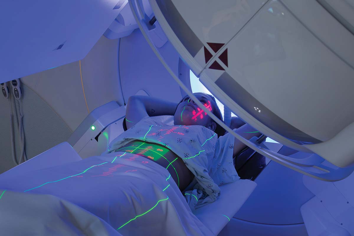 Stimularea sau inhibarea autofagiei și radioterapia pentru cancer