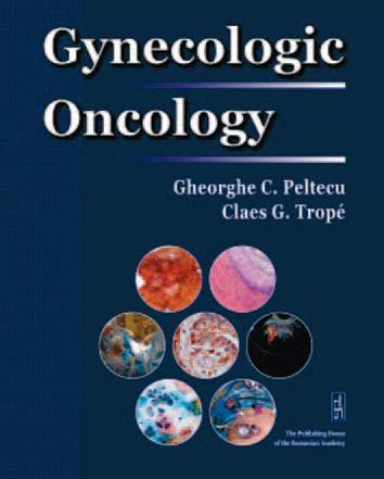 Oncologie ginecologică