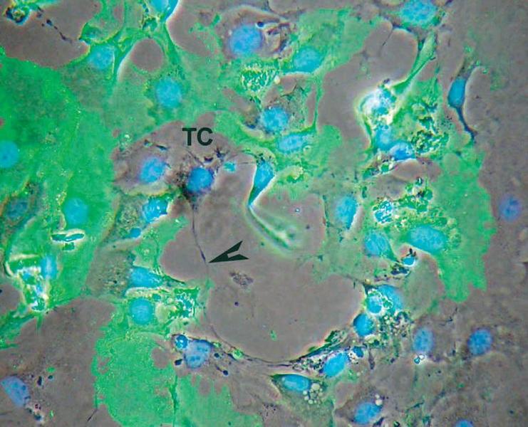 Telocite şi celule stem în cord