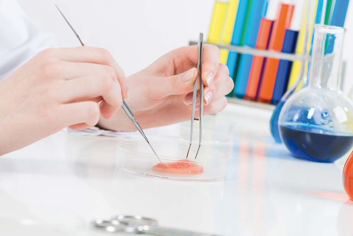 Biomaterial ce previne respingerea transplantului în DZ1