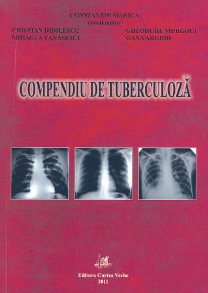 Noutăţi despre o boală veche