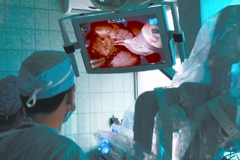Laparoscopie tradiţională şi asistată robotic în Urologie şi Ginecologie Transmisiuni live 3D