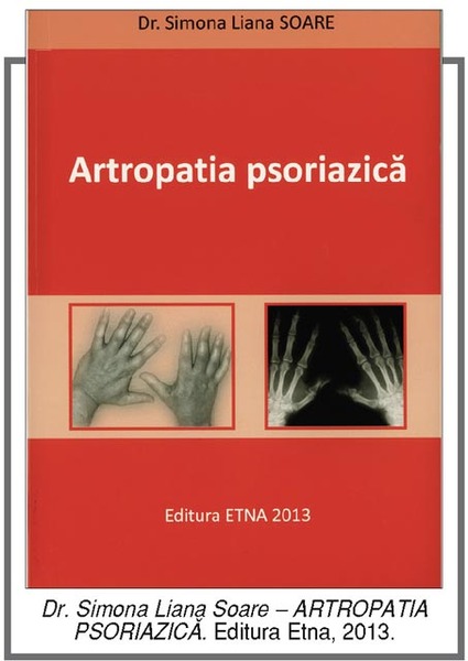 Informaţii utile, dar fără diacritice