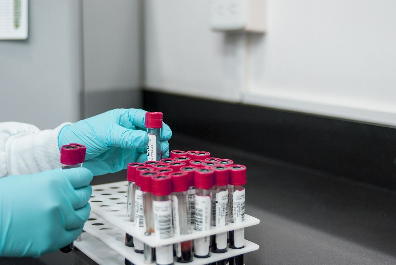DSP Alba: Teste RT-PCR pentru detectarea virusurilor gripale sezoniere