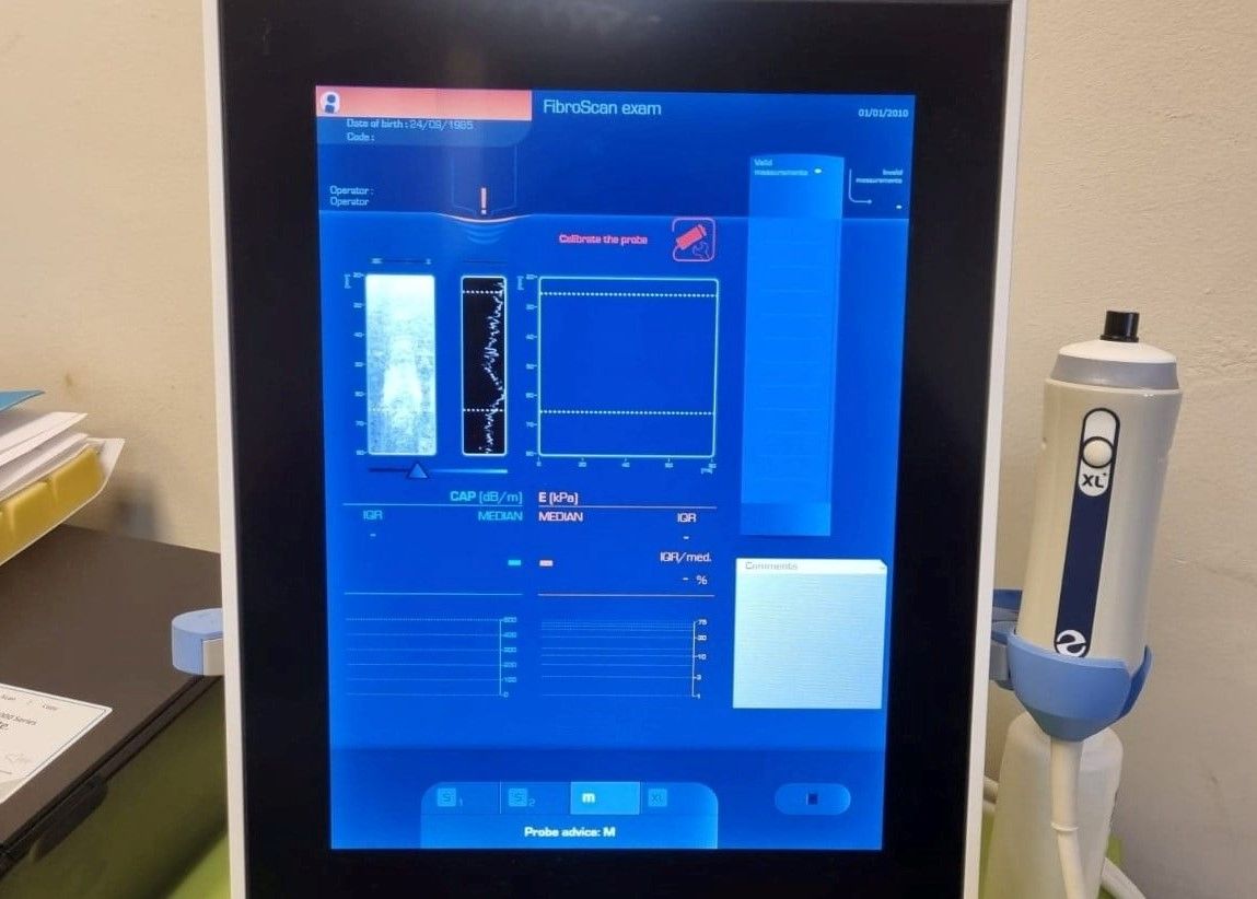 Spitalul „Victor Babeş” Timişoara, dotat cu un aparat pentru investigația ficatului