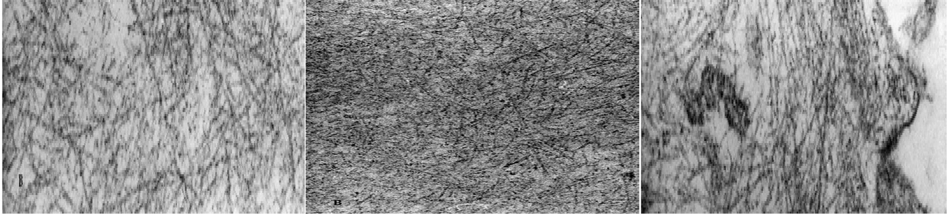 Fig. 1 - Fibrile de amiloid (microscopie electronică)