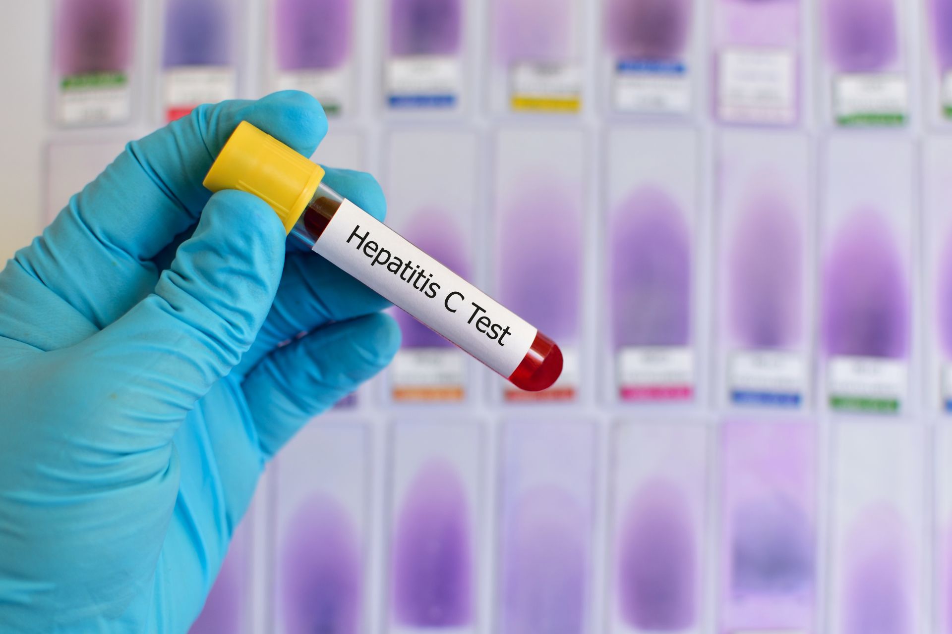 Campanie de testare pentru hepatite virale în județele Suceava și Tulcea
