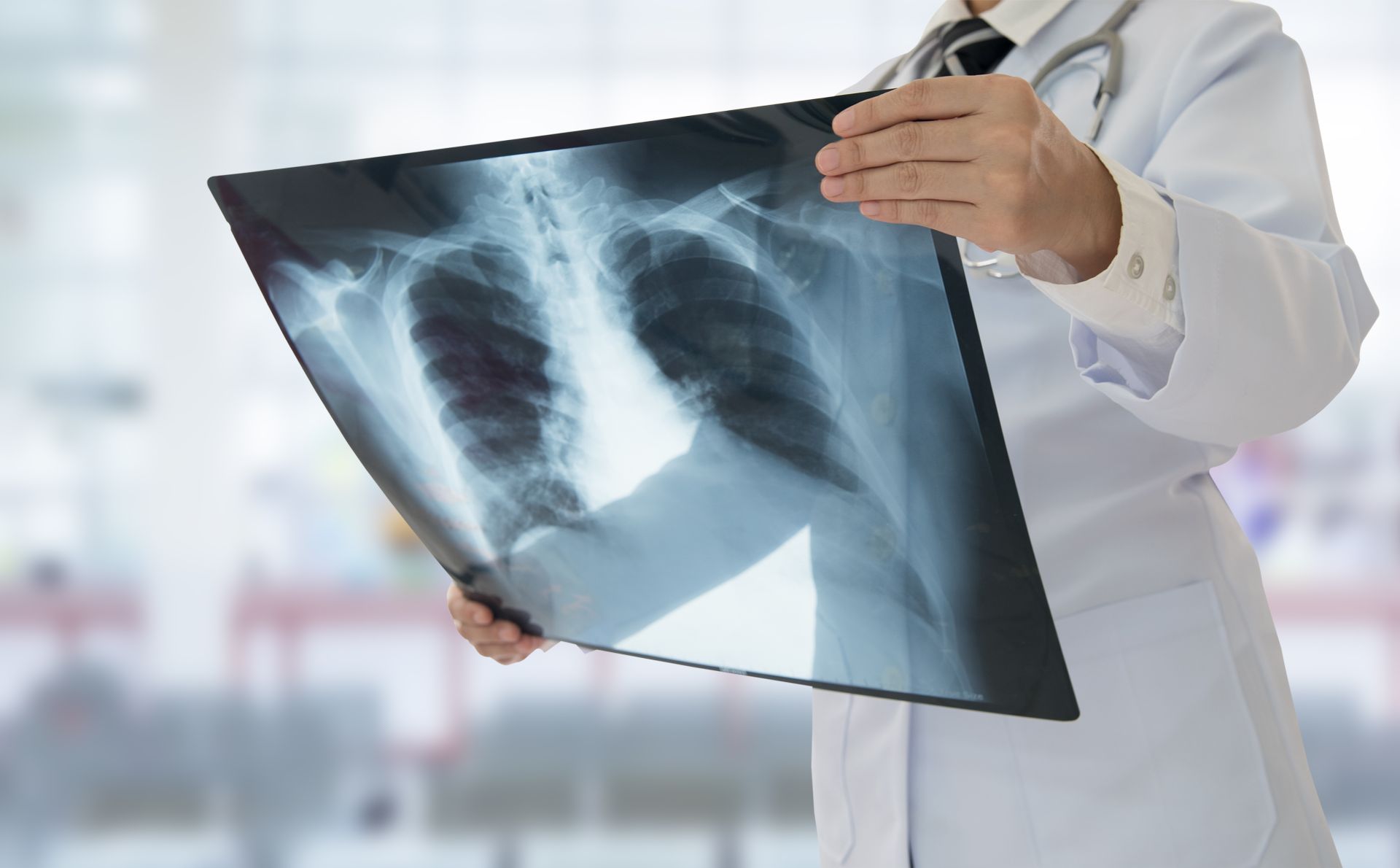 Pacienții cu tuberculoză vor putea fi tratați și ambulatoriu