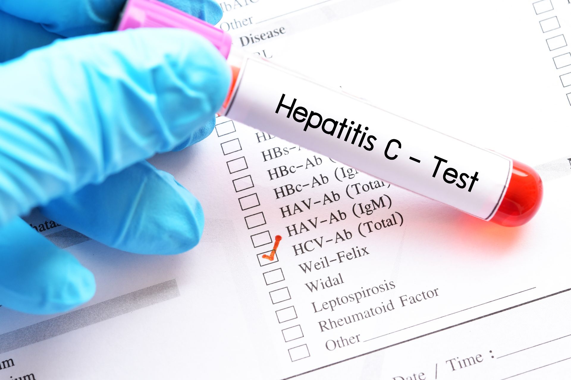 Aproape 160.000 de persoane au fost testate pentru hepatitele virale B și C