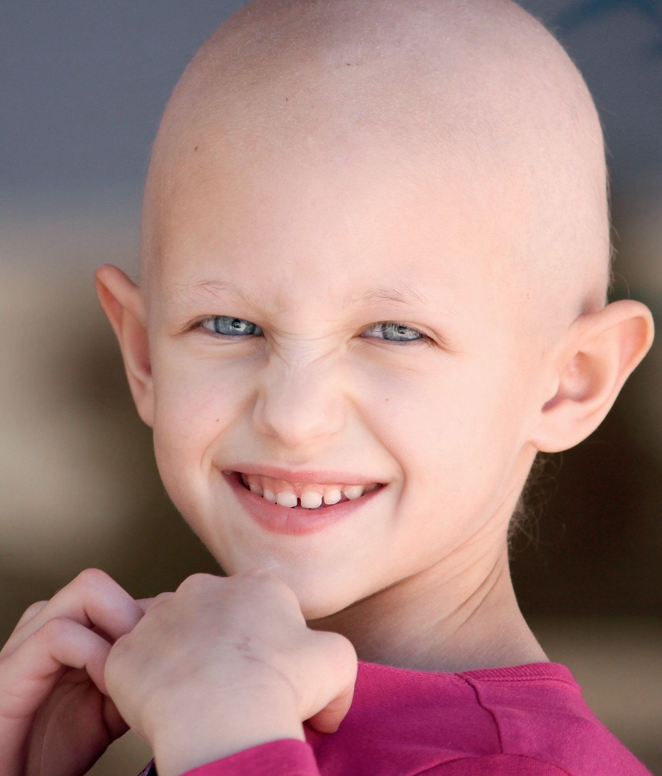 Alimentaţia copiilor cu leucemie în perioada chimioterapiei