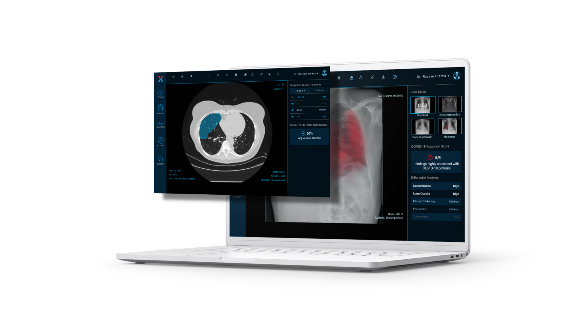 Aplicația XVision va fi prezentă la Congresul Național de Radiologie și Imagistică Medicală
