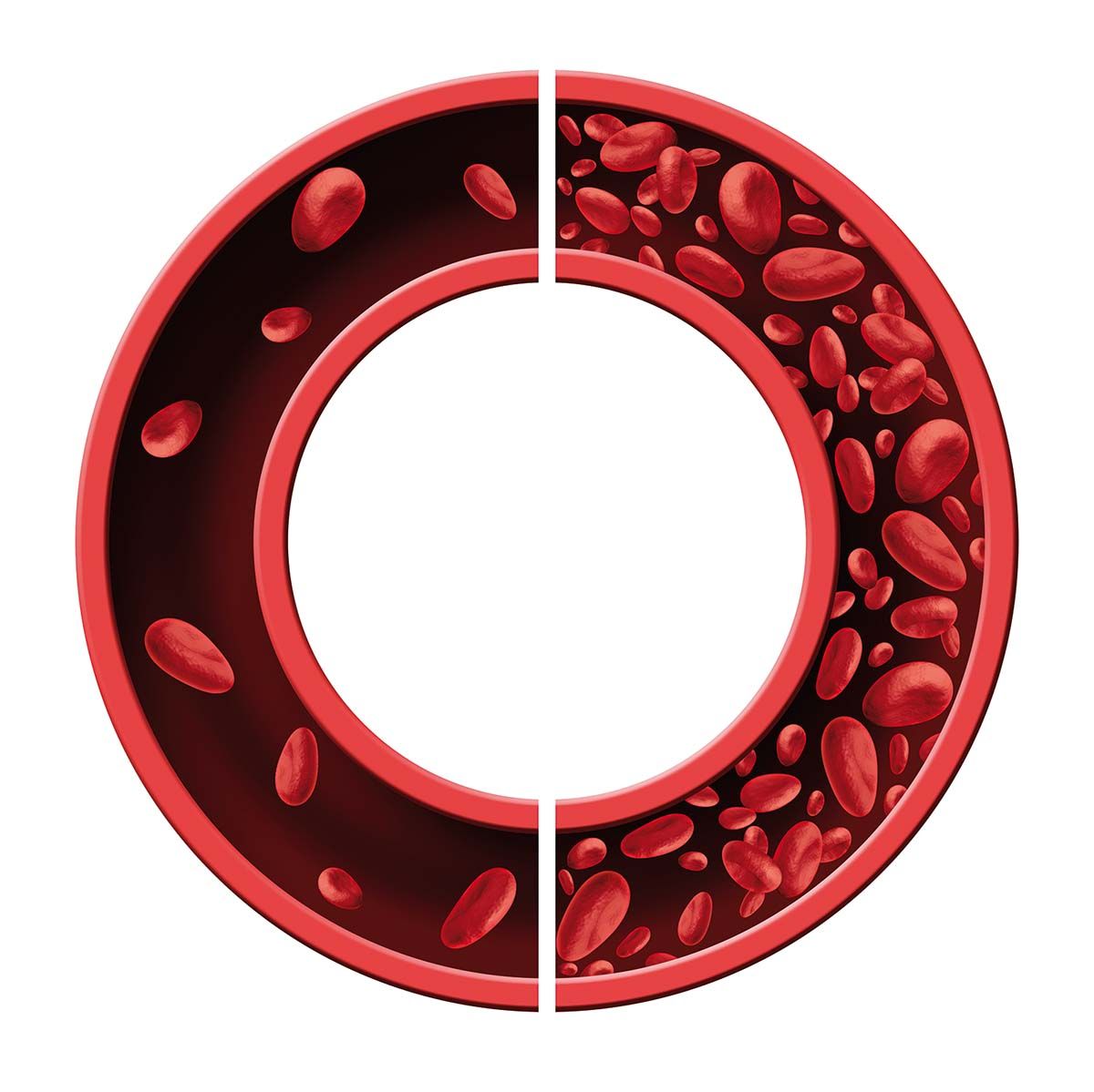Diagnosticul hematologic al anemiilor la vârstnici