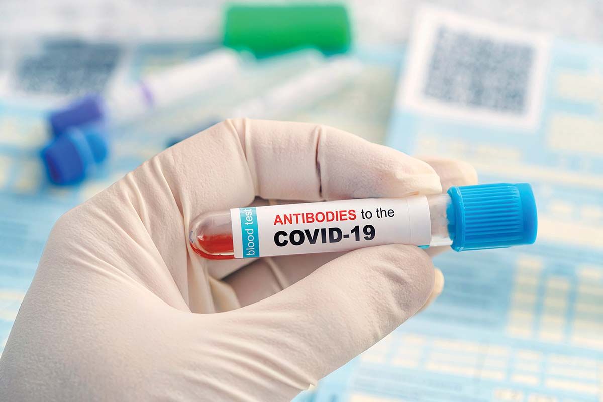 Evoluţia titrurilor de anticorpi anti-COVID