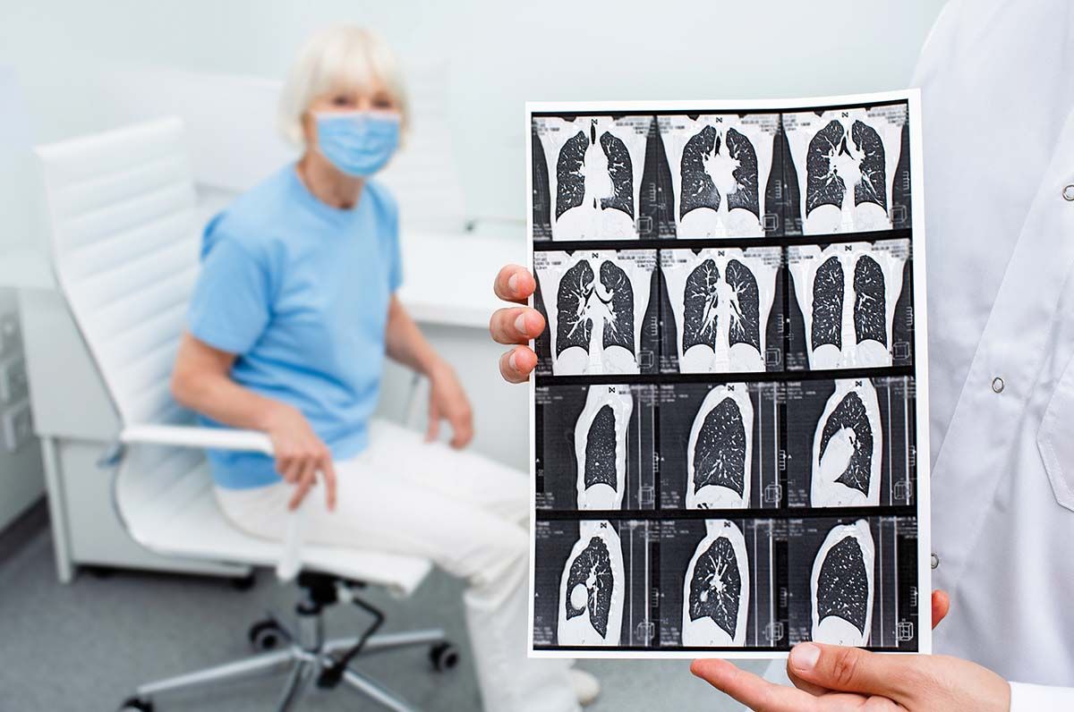 Aspecte clinice în fibroza pulmonară post-COVID