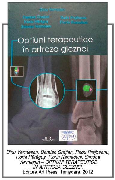 Artroza gleznei şi opţiunile sale terapeutice