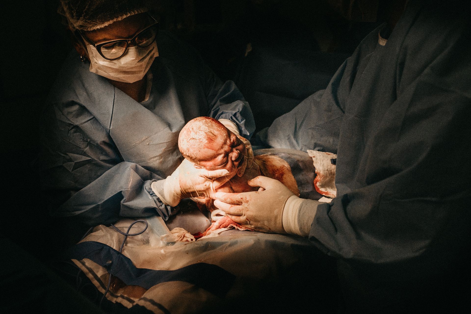 bebelus operatie cezariana