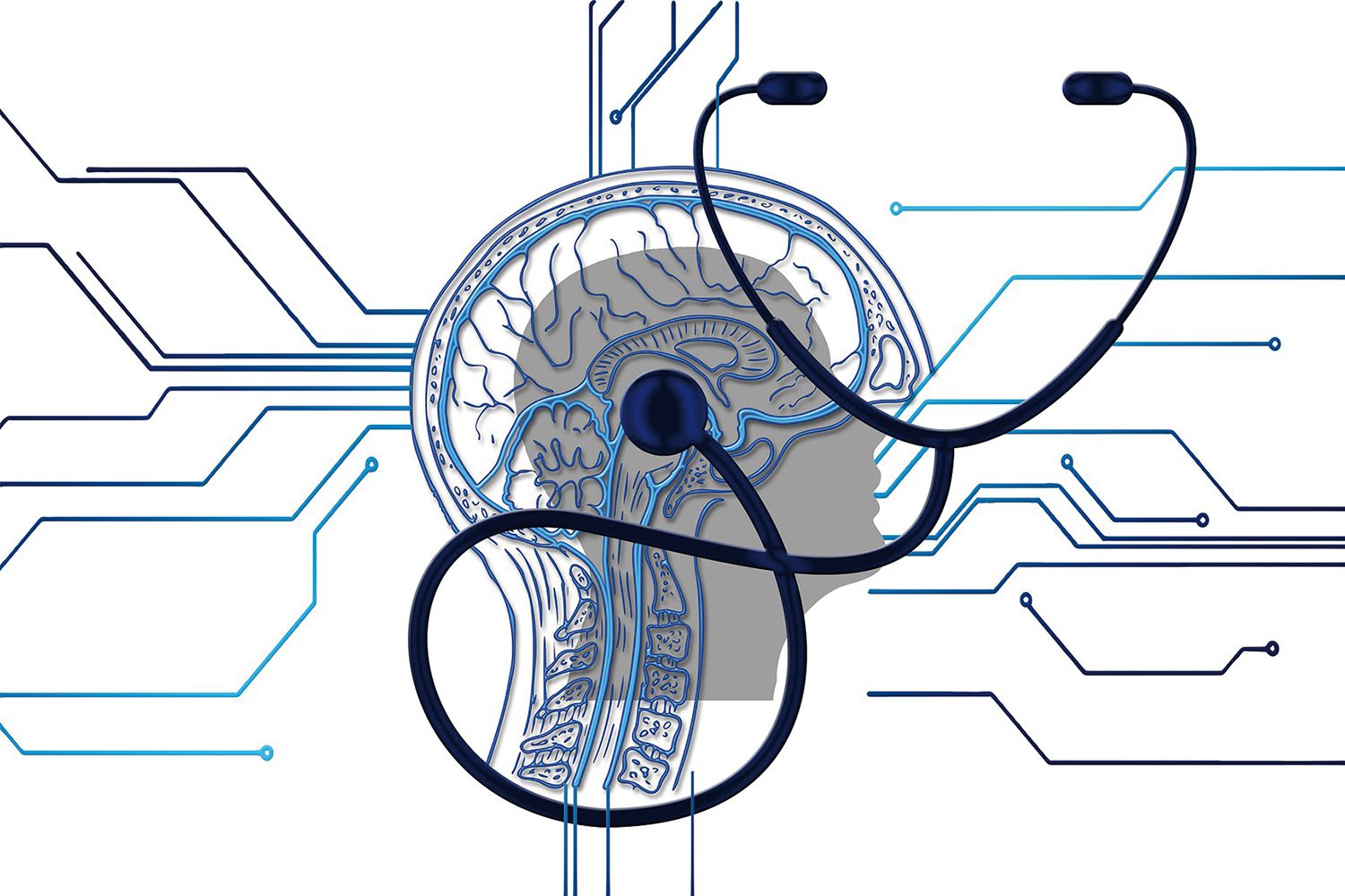 brain-4381325_1920