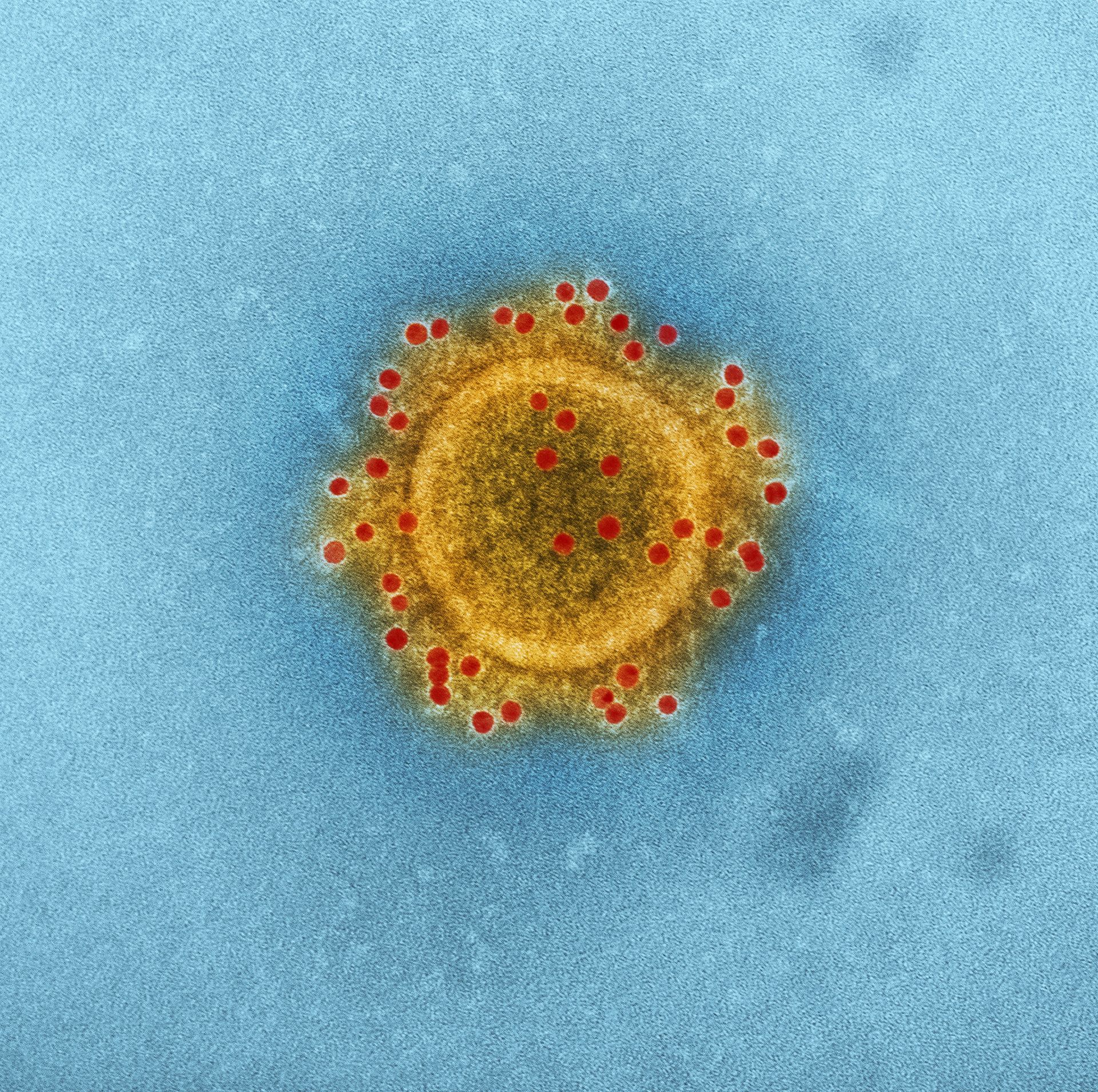 Tot ce trebuie să știți despre coronavirusul din China. Ce să le spuneți pacienților
