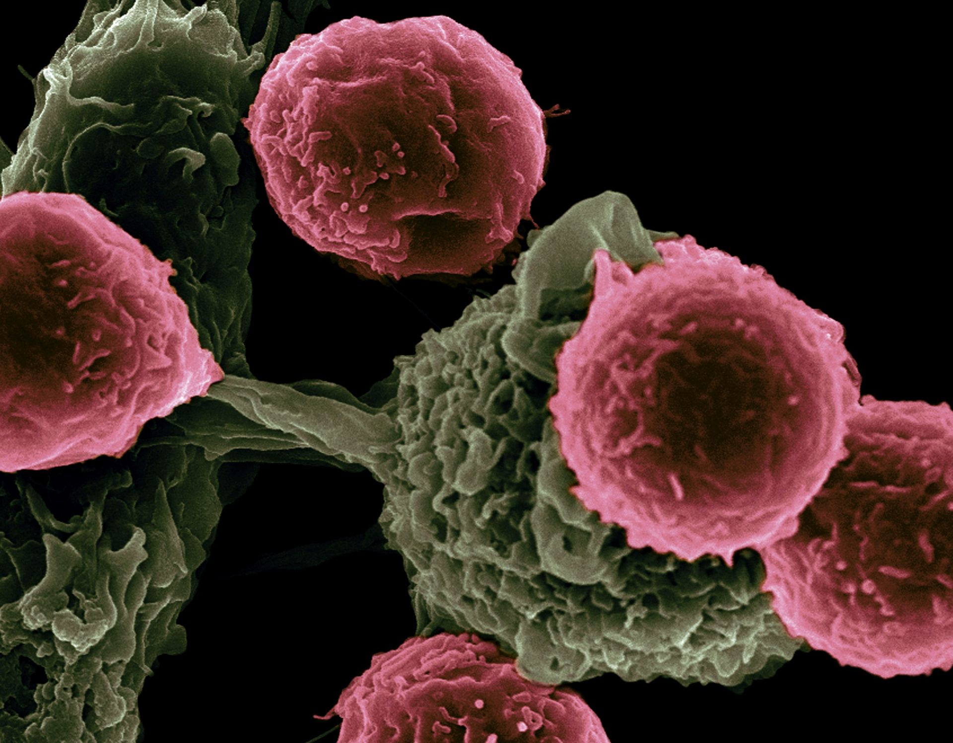 Cercetare: sistem anticancer identificat în celulele umane