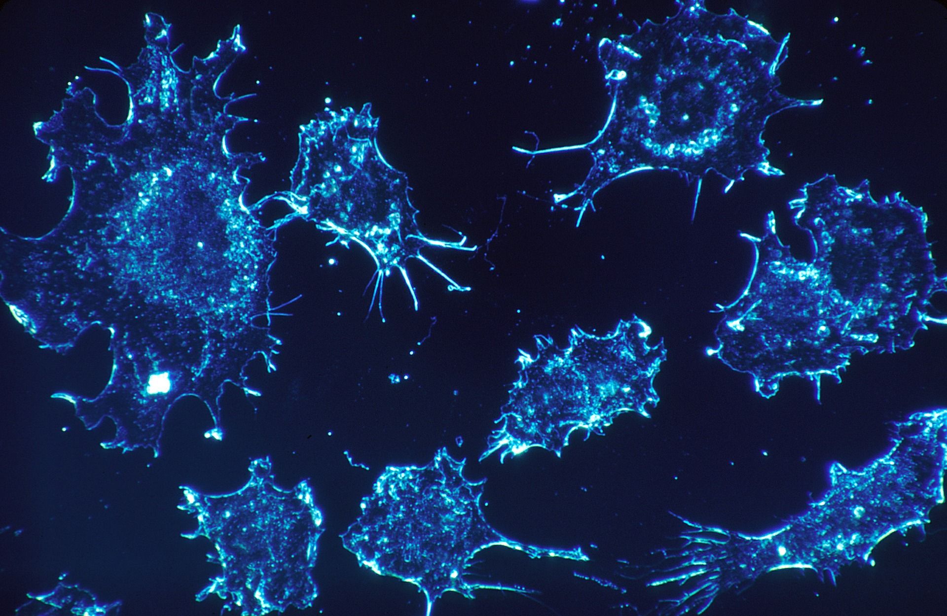 Microgravitația are potențialul de a distruge celulele canceroase