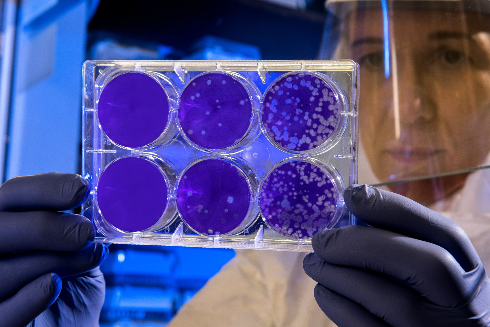 SUA: a fost detectată o bacterie care provoacă o boală infecţioasă gravă