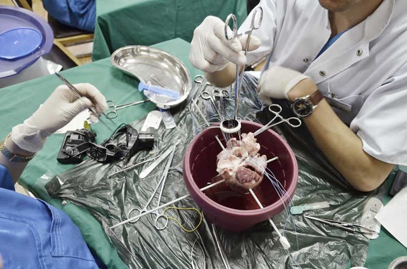 Primii paşi în chirurgia cardiovasculară