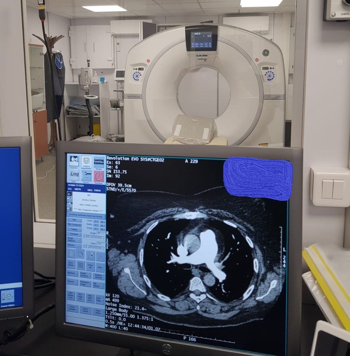 CT-ul pus în funcțiune săptămâna trecută la SCJU Arad, folosit doar pentru pacienții COVID-19