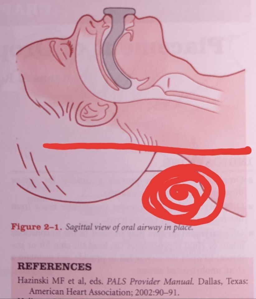 copil sufocare dr mihai craiu