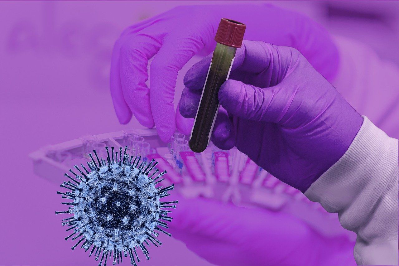 Unitate mobilă CT, care face aproape 1.000 de teste pe zi pentru a depista infecția cu coronavirus