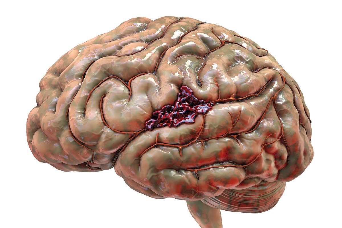 A fost obținut primul țesut cerebral uman funcțional printat 3D