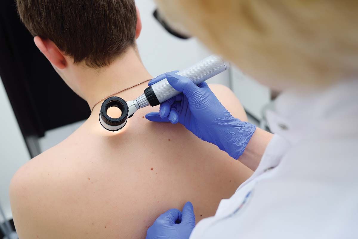 Detectarea melanomului, tot mai eficientă