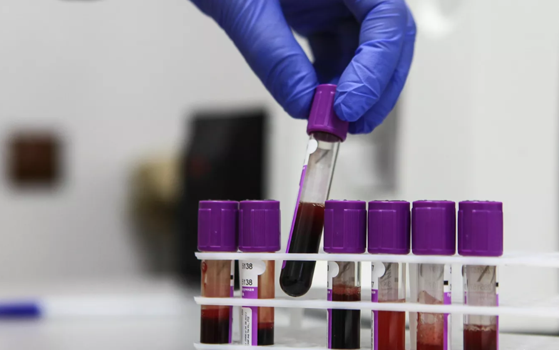Un nou test de sânge ar putea depista cancerul cu patru ani înainte să apară simptomele