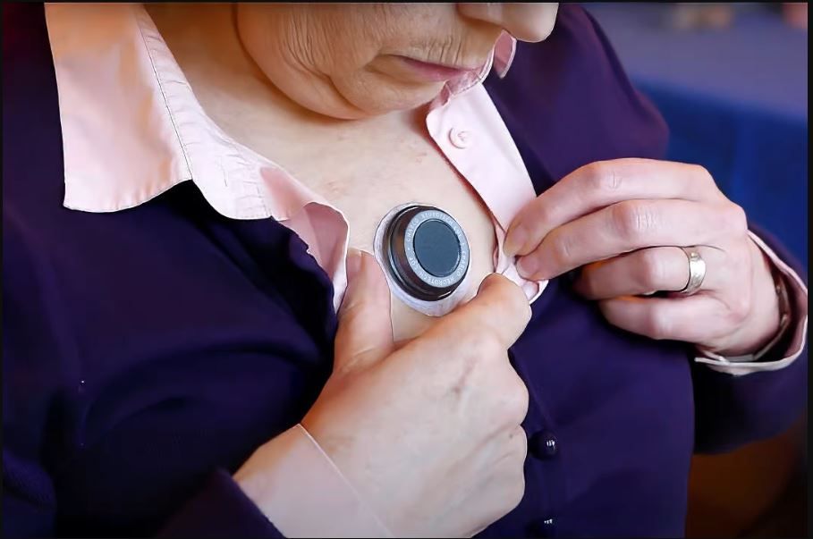 Un dispozitiv ce poate fi purtat pe piept ajută în simptomele de Parkinson
