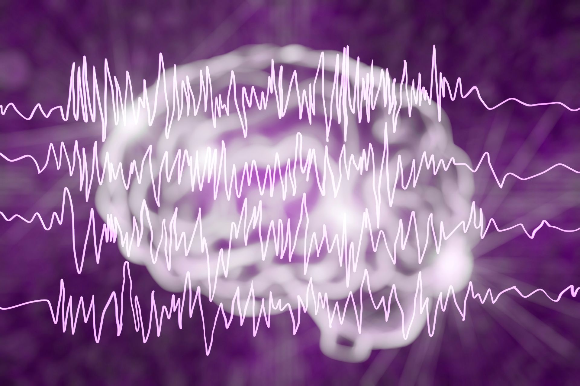 Epilepsia, între stigmatizare și ignorare