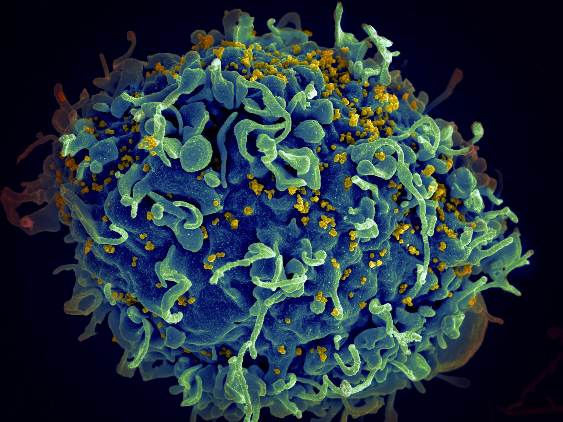 Un nou tratament anti-HIV, aprobat în Statele Unite