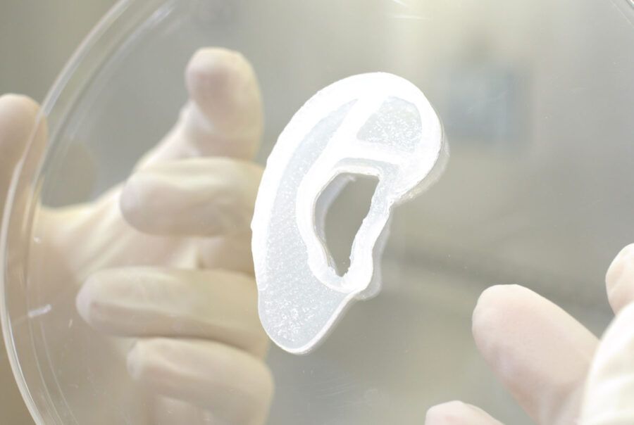 Primul implant de ureche imprimată 3D și realizată din celule umane