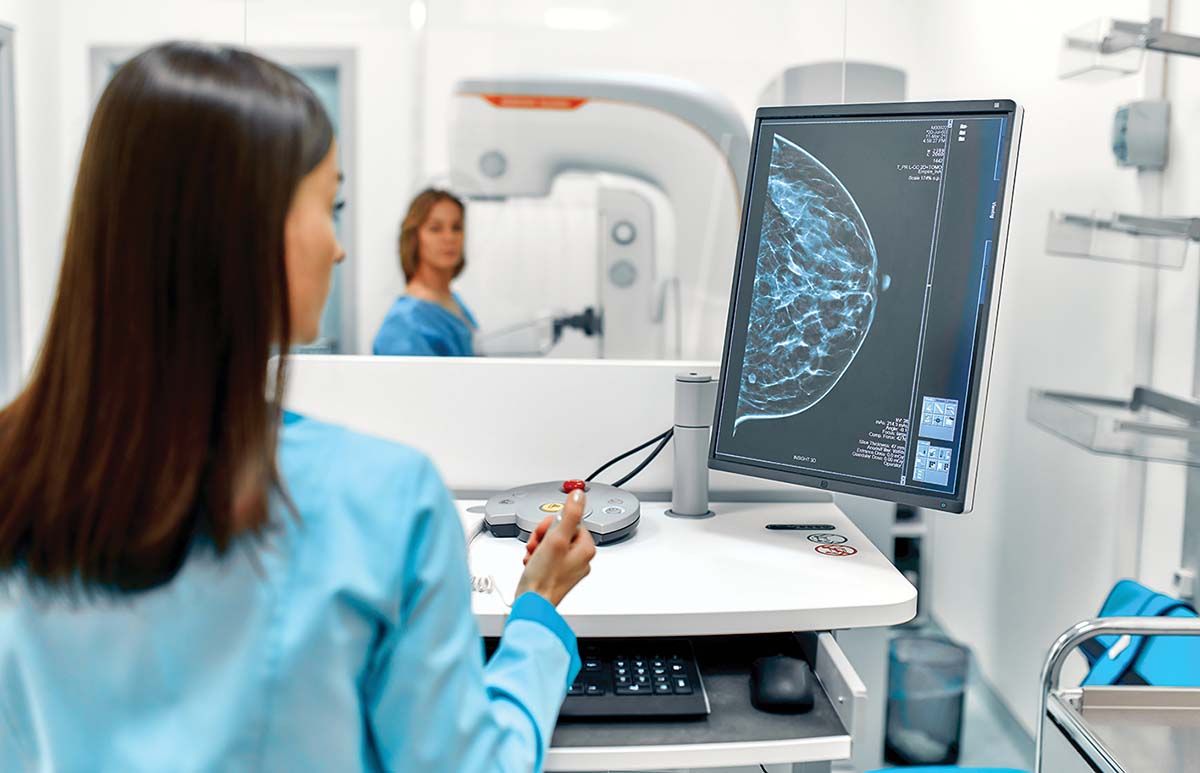 Utilizarea IA în interpretarea mamografiilor