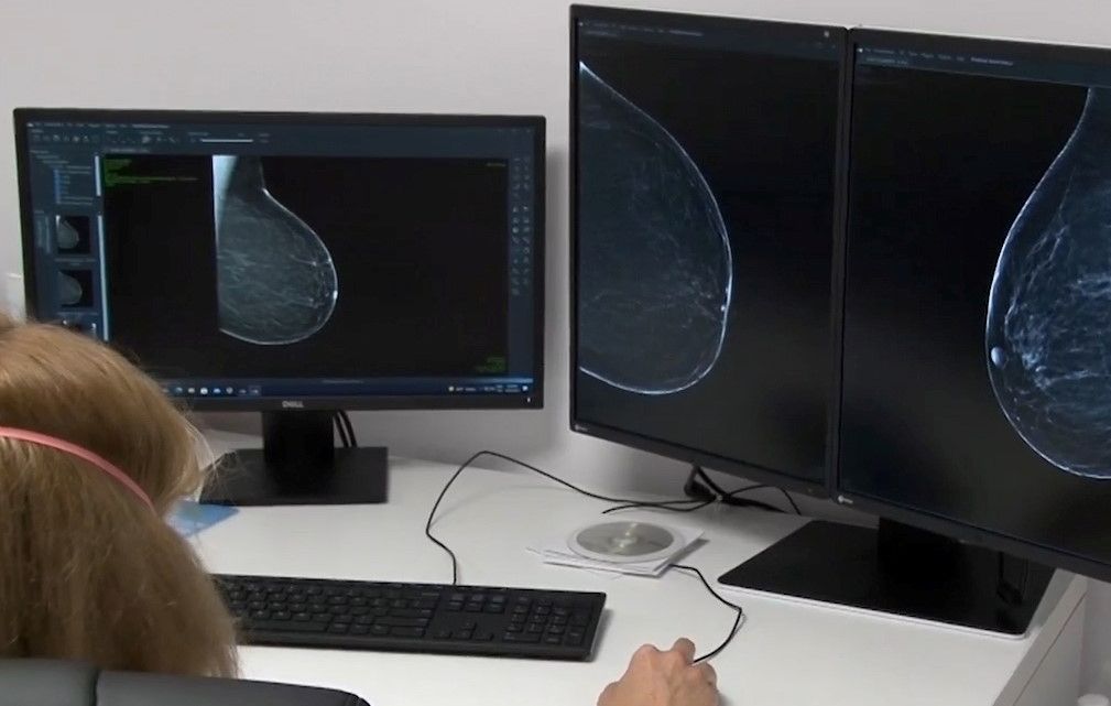 Spitalul Victor Babeş Timişoara se alătură campaniei de mamografii gratuite