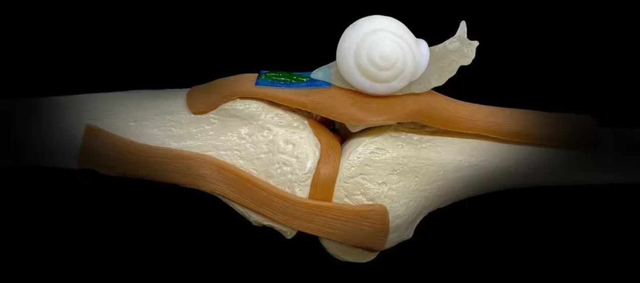 Un biomaterial inspirat de mâzga melcilor accelerează vindecarea tendoanelor