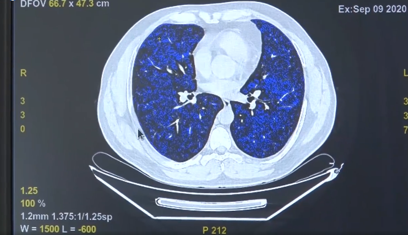 medicii timisoreni inventie