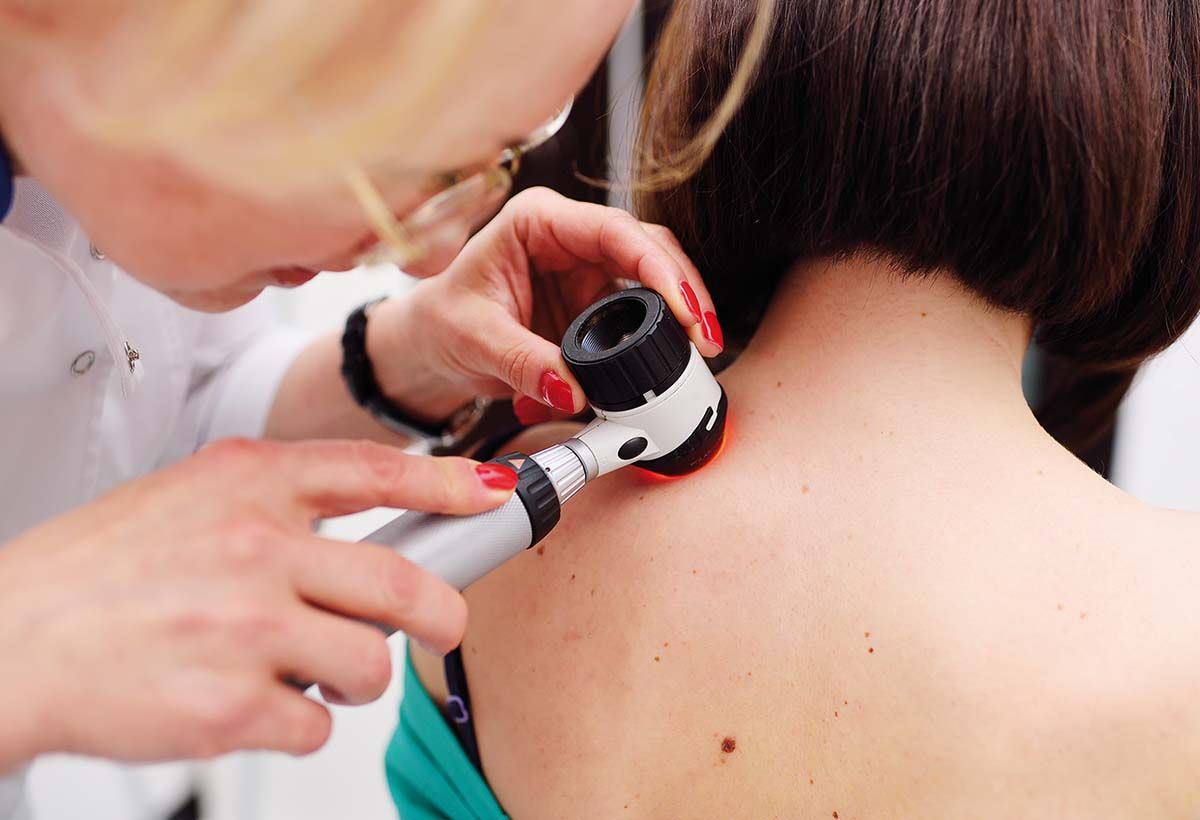 Diagnosticarea melanomului, o cursă contracronometru