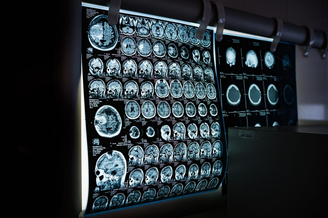 Peste 1.200 de neurologi, de pe patru continente, într-un regal al cercetării ştiinţifice medicale
