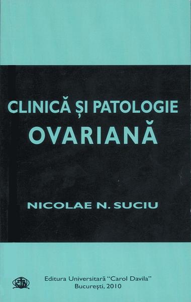 Patologia ovariană: diagnostic şi tratament