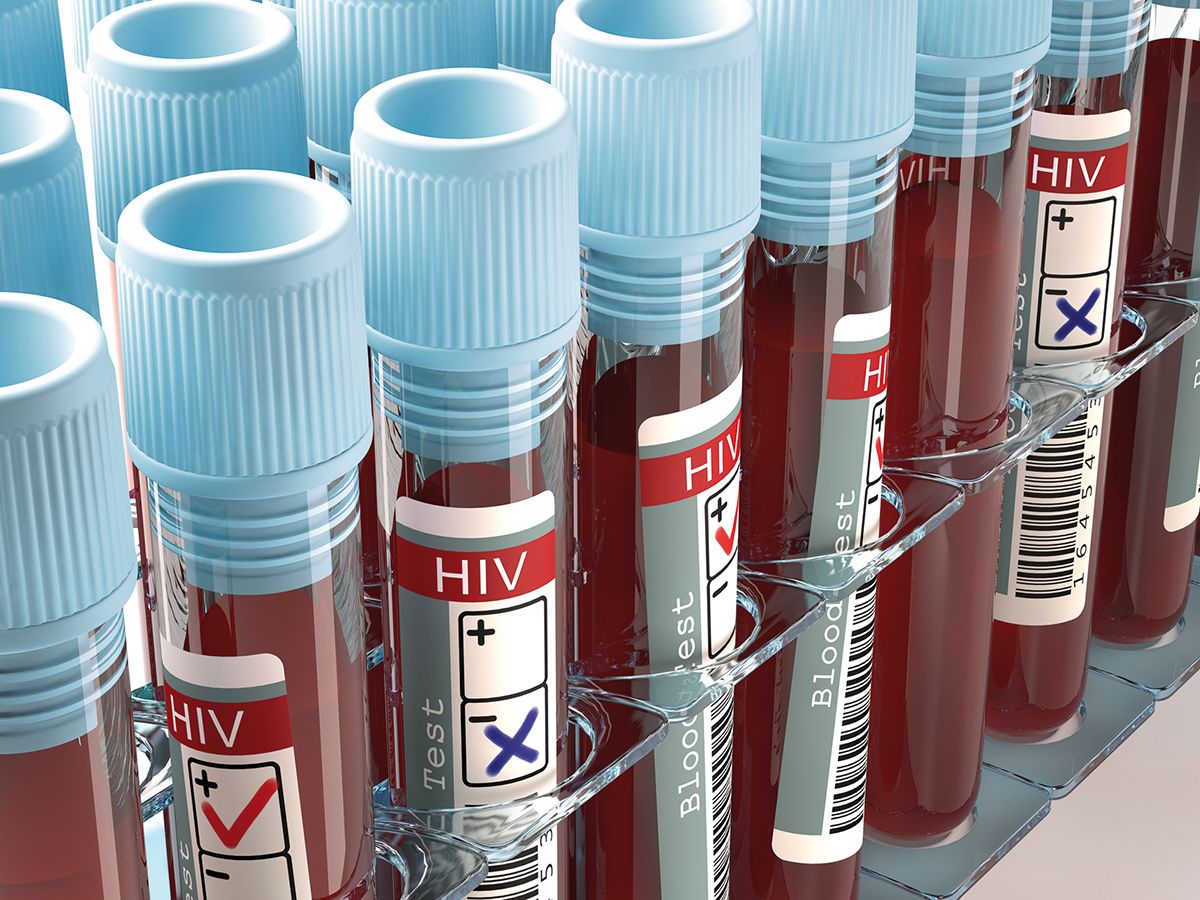 Accesul la consultaţii, o provocare pentru pacienţii cu HIV/SIDA