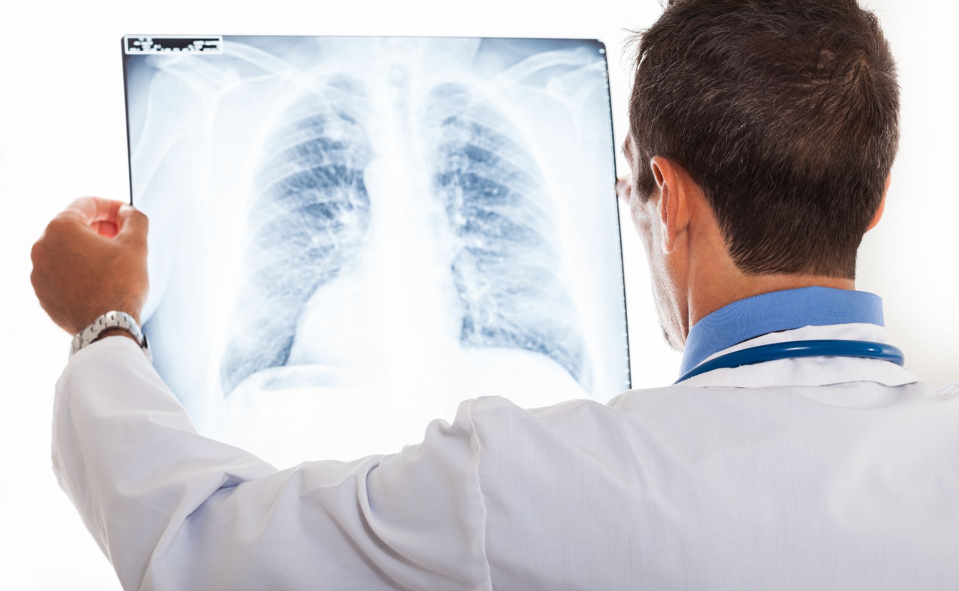 Speranţă pentru pacienţii cu boli pulmonare rare