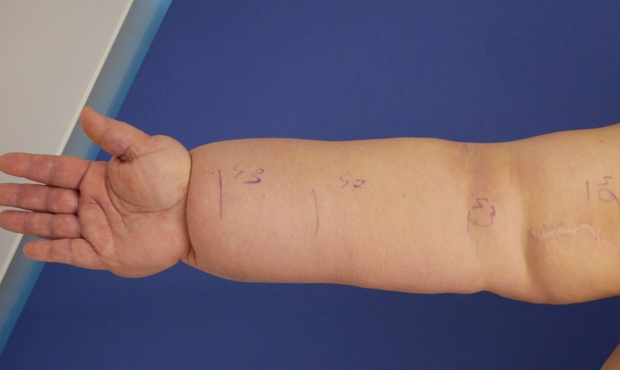 premiera-medicala-zetta