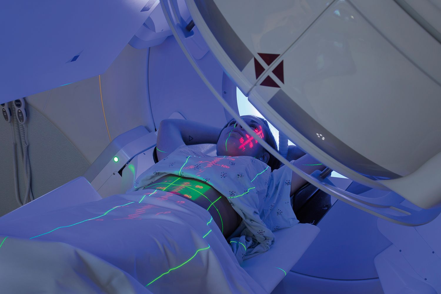 Radioterapia în tratamentul pacienţilor cu COVID-19 cu evoluţie severă