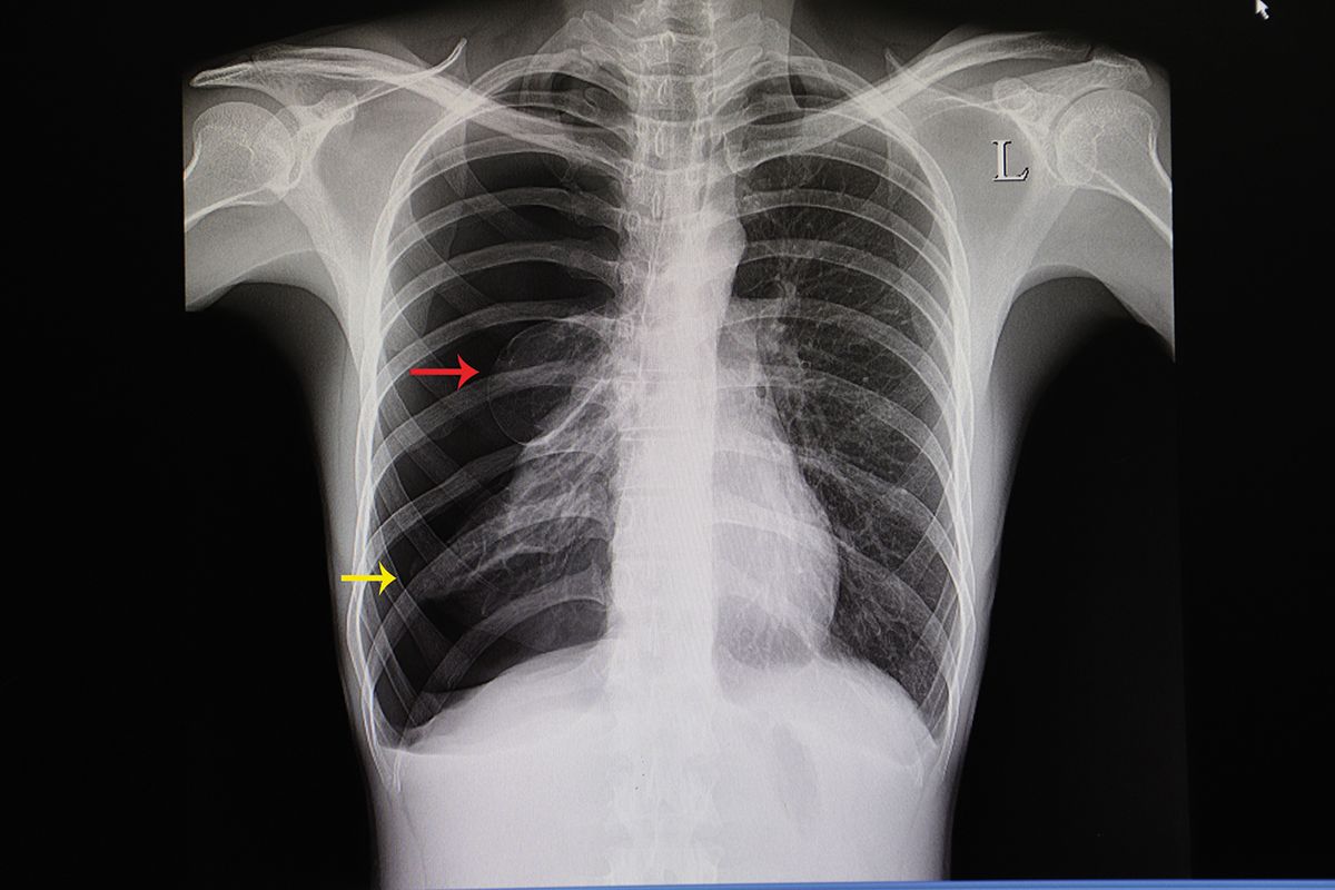 radiografie