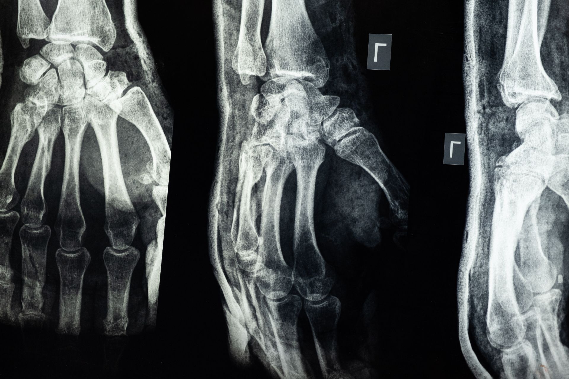 Un ortoped a încercat să vândă o radiografie ca operă de artă