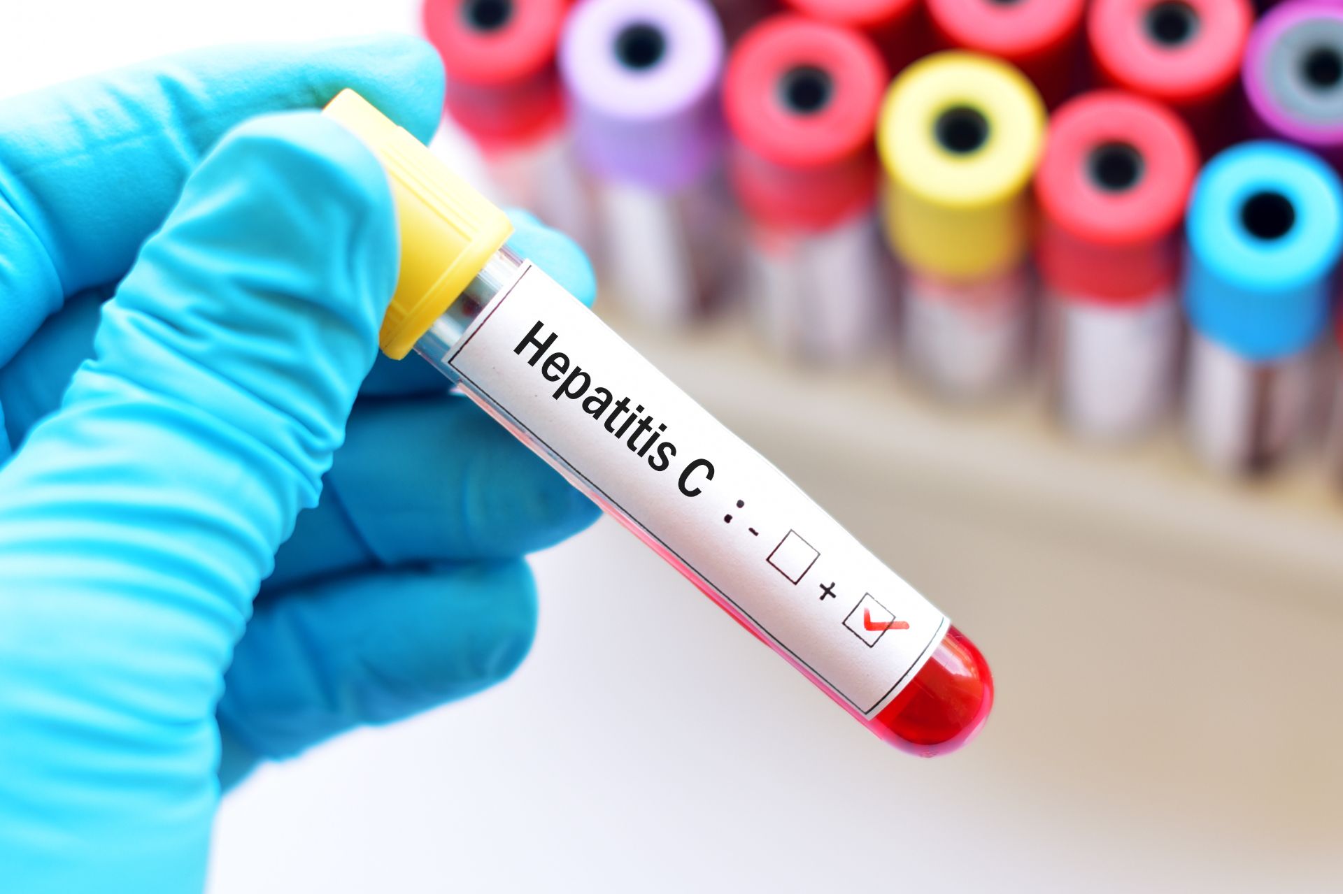 Screening pentru hepatitele virale în Argeș